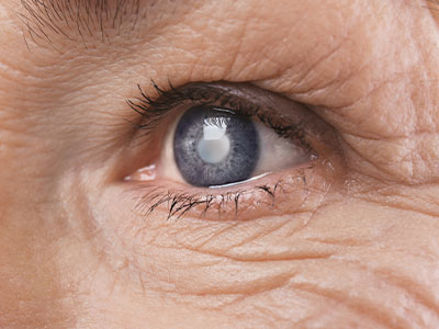 Brook Plaza Ophthalmology | Cataract Diagnosis   Management, Diabetic Eye Exams and Comprehensive Eye Exams